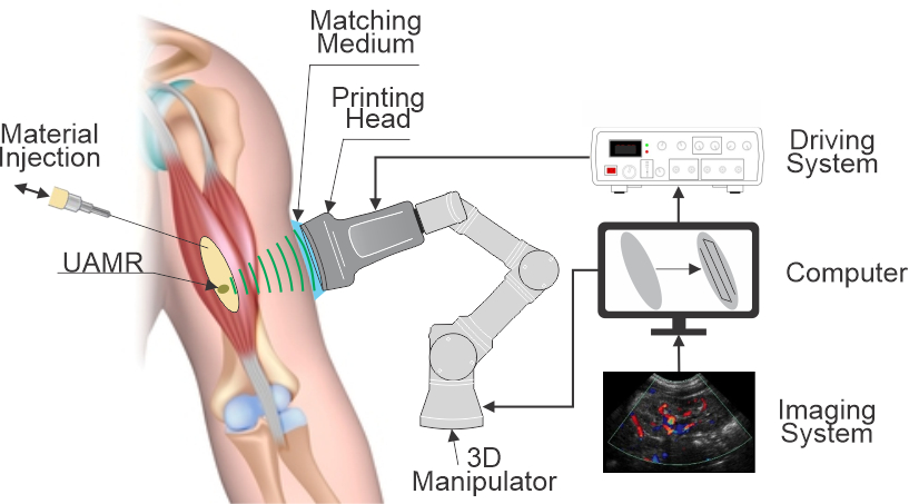 A figure shows 3D printing with biomaterial inside the human body