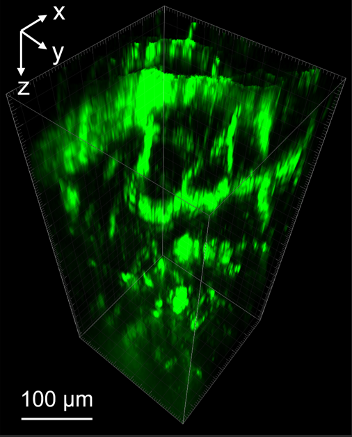 Green and black scan of mouse brain