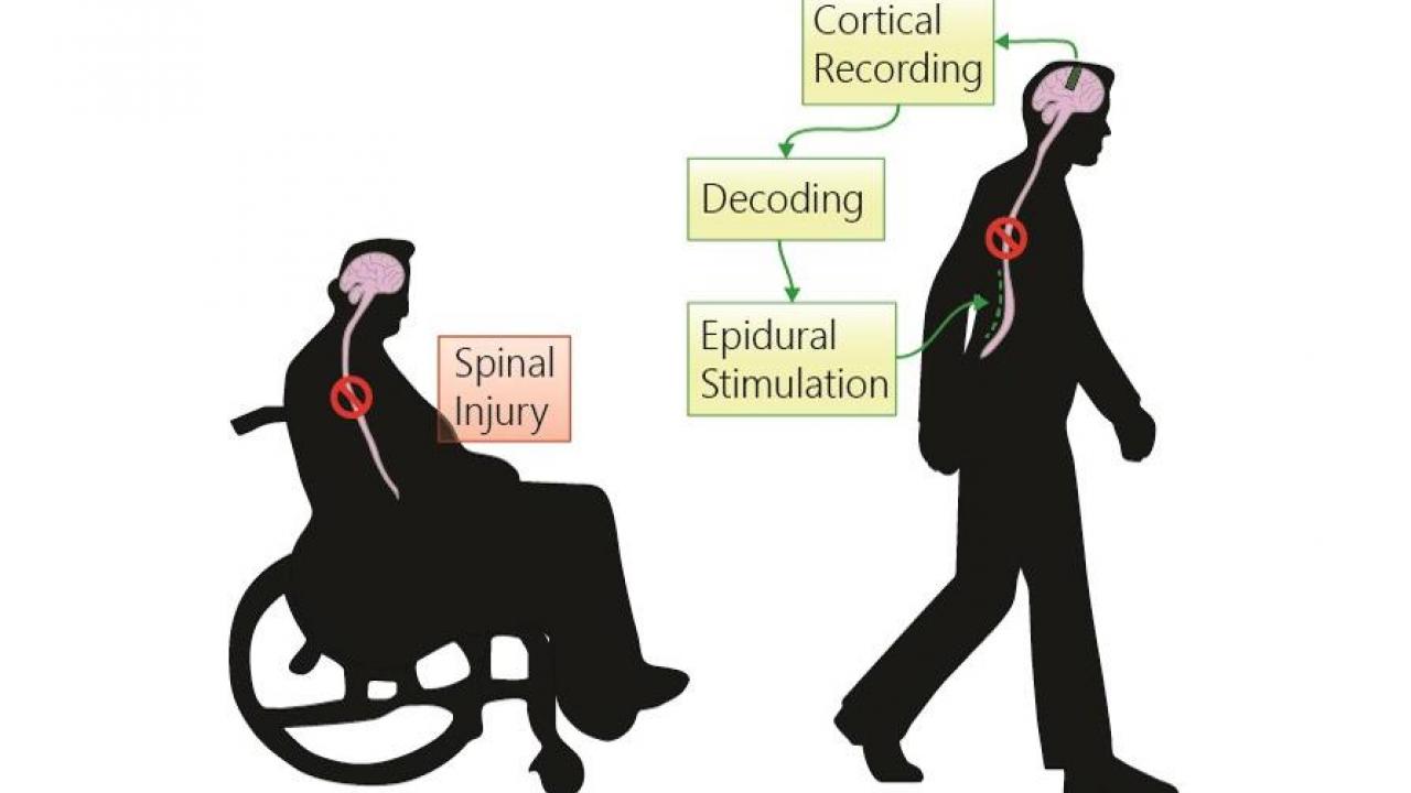 Image of spinal cord injury monitoring. 