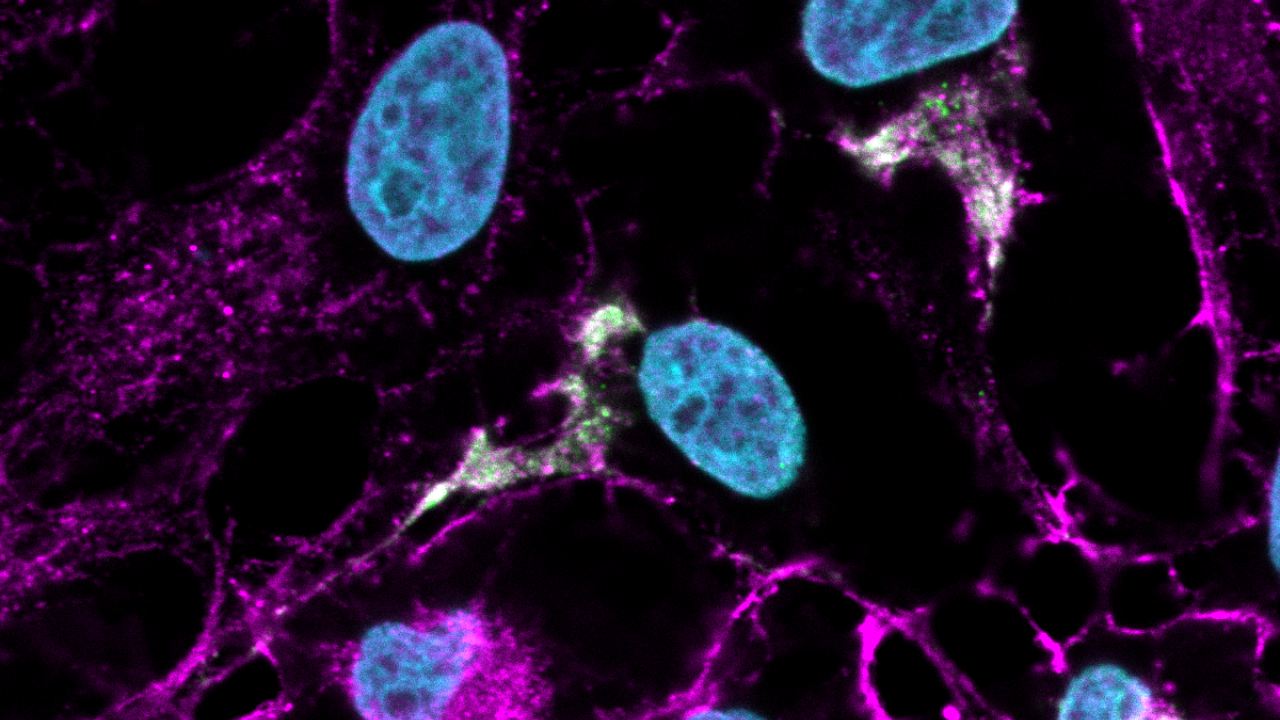 Blue, green and magenta cells against a dark background