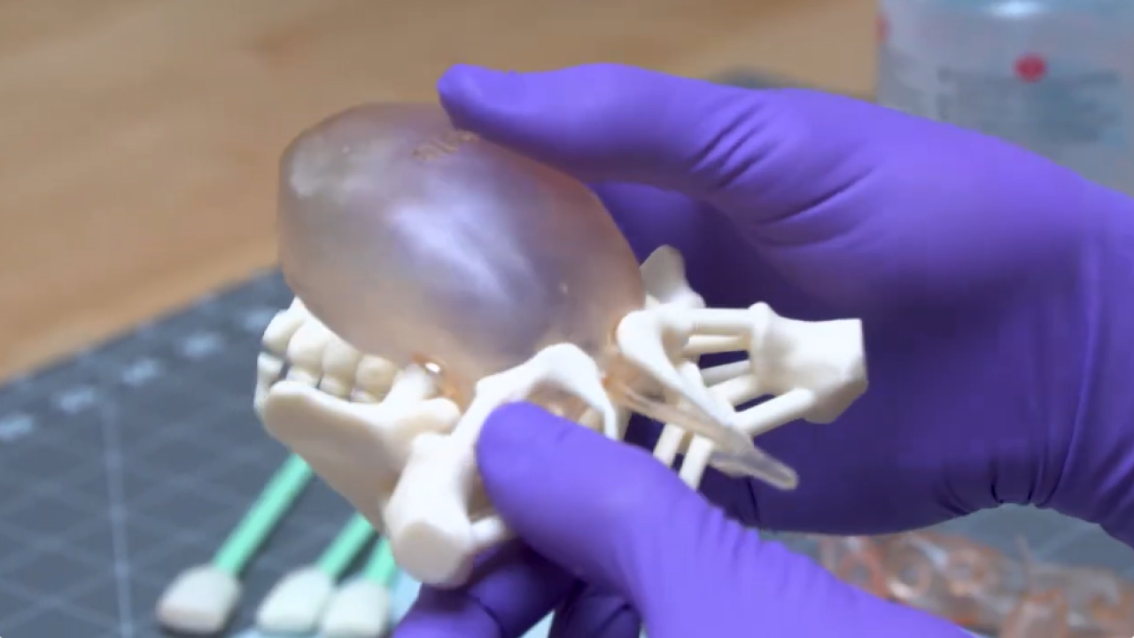 A 3D-printed model of someone with common cloaca