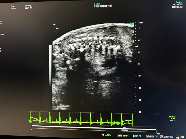 Rat fatty tissue seen through an ultrasound display 