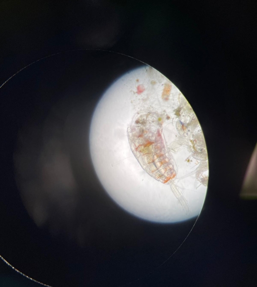 Plankton through a microscope lens