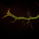 Green dots come together to make a vein-like image