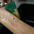 A wearable, skin-interfacing device