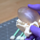 A 3D-printed model of someone with common cloaca