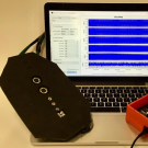 A laptop connected to the prototype of the transabdominal fetal oximetry device
