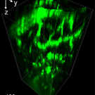 Green and black scan of mouse brain