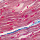 desmosomes connect cells to each other, depicted in pink/red tones