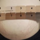 skin tone measurement on a belly