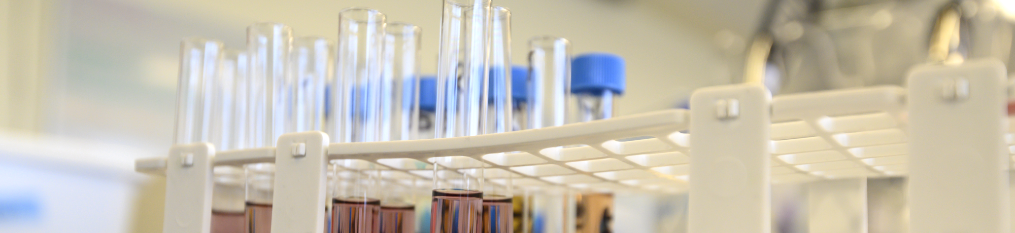 Test tubes in a lab